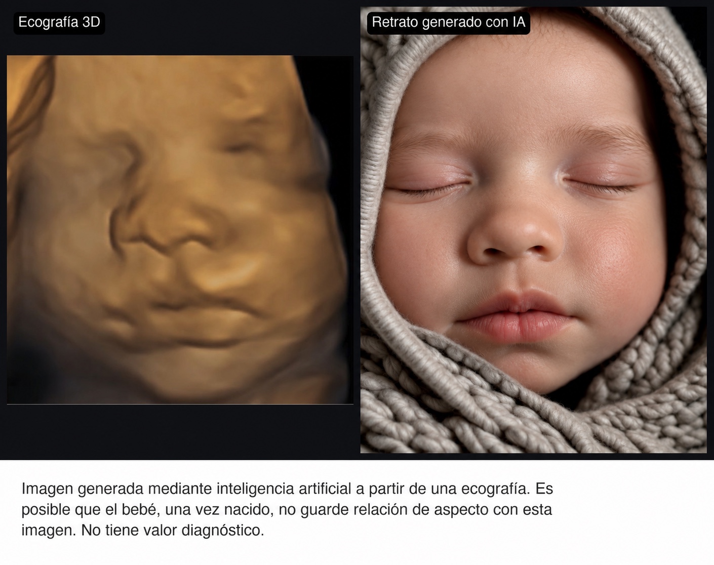 Composición de ejemplo con la ecografía y su retrato generado