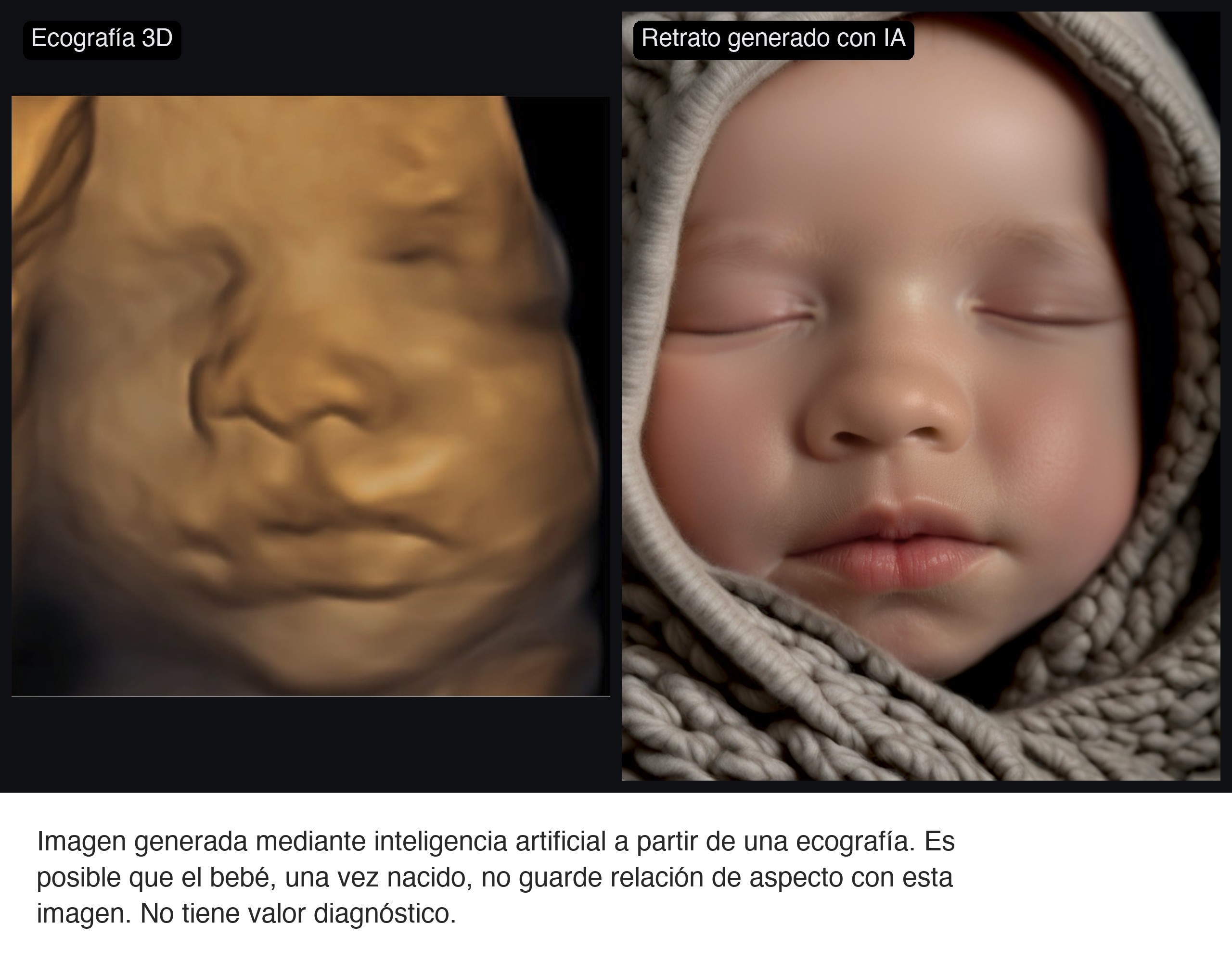 Composición de ejemplo con la ecografía y su retrato generado